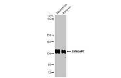 Invitrogen SynGAP Recombinant Rabbit Monoclonal Antibody (HL2292) 100 &mu;L;