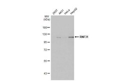 Invitrogen RNF31 Recombinant Rabbit Monoclonal Antibody (HL2295) 100 &mu;L;