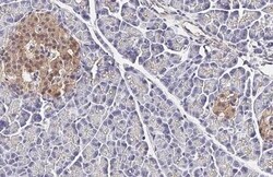 Invitrogen GLP1R Recombinant Rabbit Monoclonal Antibody (HL2297) 100 &mu;L | Buy Online | Invitrogen&trade; | Fisher Scientific