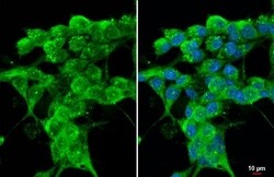 Invitrogen Cathepsin S Recombinant Rabbit Monoclonal Antibody (HL2302)