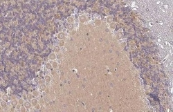Invitrogen VPS34 Recombinant Rabbit Monoclonal Antibody (HL2305) 100 &mu;L;