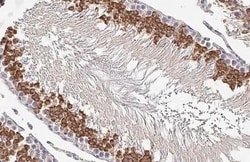 Invitrogen MNT Recombinant Rabbit Monoclonal Antibody (HL2309) 100 &mu;L;