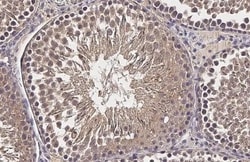 Invitrogen CP110 Recombinant Rabbit Monoclonal Antibody (HL2312) 100 &mu;L;