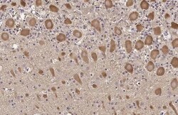 Invitrogen TLR3 Recombinant Rabbit Monoclonal Antibody (HL2314) 100 &mu;L | Buy Online | Invitrogen&trade; | Fisher Scientific