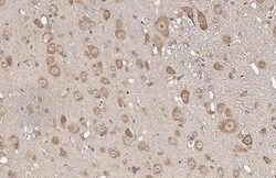 Invitrogen RPL32 Recombinant Rabbit Monoclonal Antibody (HL2329) 100 &mu;L;