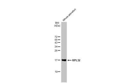 Invitrogen RPL32 Recombinant Rabbit Monoclonal Antibody (HL2329) 100 &mu;L;