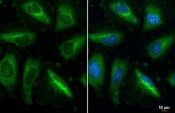 Invitrogen&trade;&nbsp;RPL32 Recombinant Rabbit Monoclonal Antibody (HL2331)