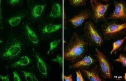 Invitrogen RNaseL Recombinant Rabbit Monoclonal Antibody (HL2340) 100 &mu;L | Buy Online | Invitrogen&trade; | Fisher Scientific