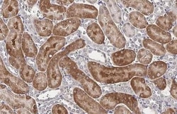 Invitrogen RNaseL Recombinant Rabbit Monoclonal Antibody (HL2340) 100 &mu;L | Buy Online | Invitrogen&trade; | Fisher Scientific