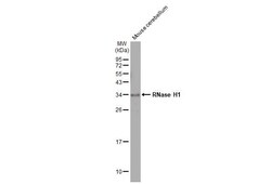 Invitrogen RNaseH1 Recombinant Rabbit Monoclonal Antibody (HL2343) 100