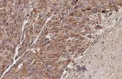 Invitrogen PELO Recombinant Rabbit Monoclonal Antibody (HL2345) 100 &mu;L;