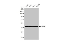 Invitrogen PELO Recombinant Rabbit Monoclonal Antibody (HL2345) 100 &mu;L;