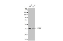 Invitrogen PELO Recombinant Rabbit Monoclonal Antibody (HL2345) 100 &mu;L;