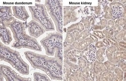 Invitrogen ATG4B Recombinant Rabbit Monoclonal Antibody (HL2348) 100 &mu;L;