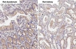 Invitrogen ATG4B Recombinant Rabbit Monoclonal Antibody (HL2348) 100 &mu;L;
