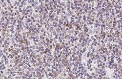 Invitrogen TNF alpha Recombinant Rabbit Monoclonal Antibody (HL2361) 100