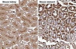 Invitrogen WNT10B Recombinant Rabbit Monoclonal Antibody (HL2370) 100 &mu;L;