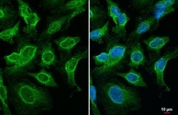 Invitrogen SNX5 Recombinant Rabbit Monoclonal Antibody (HL2375) 100 &mu;L;
