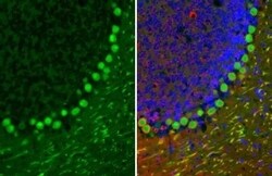 Invitrogen Calbindin D28K Recombinant Rabbit Monoclonal Antibody (HL2379)