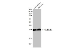 Invitrogen Calbindin D28K Recombinant Rabbit Monoclonal Antibody (HL2379)