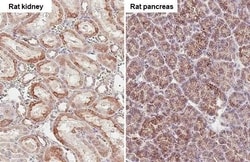 Invitrogen SUCLG1 Recombinant Rabbit Monoclonal Antibody (HL2387) 100 &mu;L;