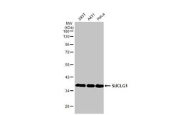 Invitrogen SUCLG1 Recombinant Rabbit Monoclonal Antibody (HL2387) 100 &mu;L;