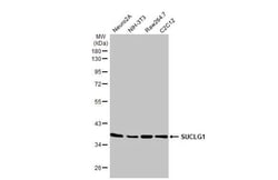 Invitrogen SUCLG1 Recombinant Rabbit Monoclonal Antibody (HL2387) 100 &mu;L;