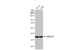 Invitrogen SUCLG1 Recombinant Rabbit Monoclonal Antibody (HL2387) 100 &mu;L;