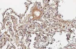 Invitrogen IL-6 Recombinant Rabbit Monoclonal Antibody (HL2389) 100 &mu;L;