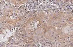 Invitrogen IL-6 Recombinant Rabbit Monoclonal Antibody (HL2389) 100 &mu;L;