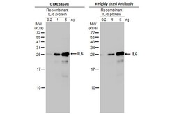 Invitrogen IL-6 Recombinant Rabbit Monoclonal Antibody (HL2389) 100 &mu;L;