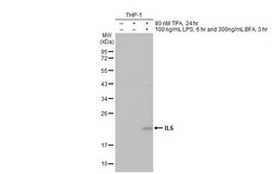 Invitrogen IL-6 Recombinant Rabbit Monoclonal Antibody (HL2389) 100 &mu;L;