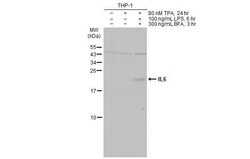 Invitrogen IL-6 Recombinant Rabbit Monoclonal Antibody (HL2389) 100 &mu;L;