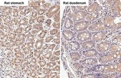 Invitrogen TBC1D5 Recombinant Rabbit Monoclonal Antibody (HL2390) 100 &mu;L;