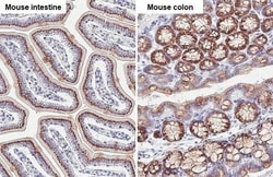 Invitrogen GALNT6 Recombinant Rabbit Monoclonal Antibody (HL2392) 100 &mu;L;