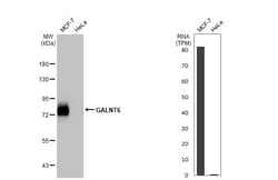 Invitrogen GALNT6 Recombinant Rabbit Monoclonal Antibody (HL2392) 100 &mu;L;