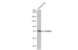 Invitrogen GALNT6 Recombinant Rabbit Monoclonal Antibody (HL2392) 100 &mu;L;
