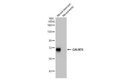 Invitrogen GALNT6 Recombinant Rabbit Monoclonal Antibody (HL2392) 100 &mu;L;