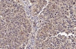 Invitrogen&trade;&nbsp;uPAR Recombinant Rabbit Monoclonal Antibody (HL2398)
