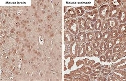 Invitrogen&trade;&nbsp;uPAR Recombinant Rabbit Monoclonal Antibody (HL2398)