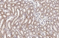 Invitrogen BCKDHA Recombinant Rabbit Monoclonal Antibody (HL2405) 100 &mu;L;