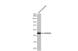 Invitrogen BCKDHA Recombinant Rabbit Monoclonal Antibody (HL2405) 100 &mu;L;