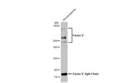Invitrogen Factor V Recombinant Rabbit Monoclonal Antibody (HL2421) 100 &mu;L | Buy Online | Invitrogen&trade; | Fisher Scientific