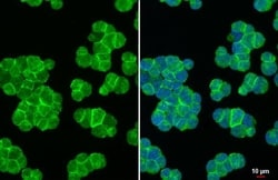 Invitrogen CXCR4 Recombinant Rabbit Monoclonal Antibody (HL2424) 100 &mu;L;
