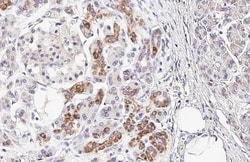 Invitrogen CXCR4 Recombinant Rabbit Monoclonal Antibody (HL2424) 100 &mu;L;
