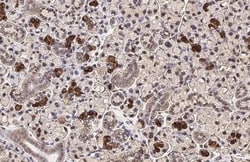 Invitrogen CXCR4 Recombinant Rabbit Monoclonal Antibody (HL2424) 100 &mu;L;