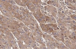 Invitrogen Transferrin Recombinant Rabbit Monoclonal Antibody (HL2431)