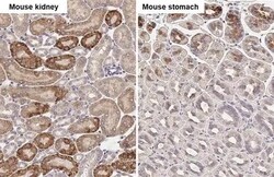 Calpain 5 Recombinant Rabbit Monoclonal Antibody (HL2432), Invitrogen 100