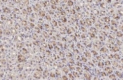 Calpain 5 Recombinant Rabbit Monoclonal Antibody (HL2432), Invitrogen 100