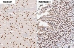 Invitrogen FUS Recombinant Rabbit Monoclonal Antibody (HL2454) 100 &mu;L;